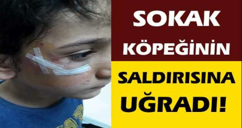 Sokak köpeğinin saldırısına uğradı