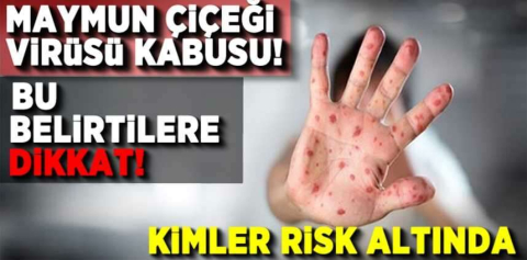 Maymun çiçeği hakkında bilinmeyenler