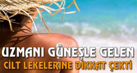 Güneşle gelen cilt lekelerine dikkat