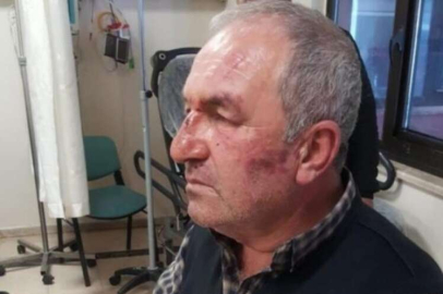 Kulak zarını patlatana kadar dövdüler!