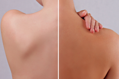 Kolay bronzlaştıran 5 yöntem! Kızarmadan bronzlaşma