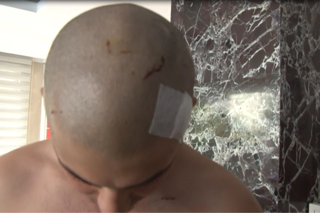 6 kişi tarafından demir çubukla dövülen genç konuştu