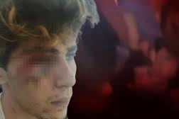 Suriyelilerden Türk gence işkence!2 kişi tutuklandı