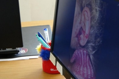 3 yaşındaki kızın kulağından çıkan dehşete düşürdü!