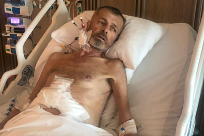 Kızının karaciğeri ile hayata tutundu